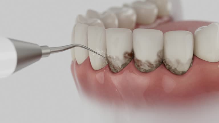 Trusted Tooth Extraction service in Mantua, VA - Dentist Open Now